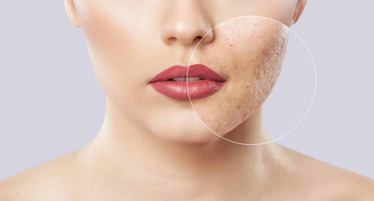 shutterstock_1346981630
